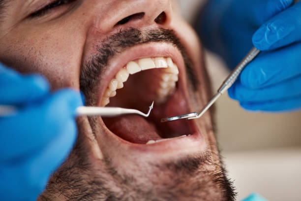 Best Tooth Infection Emergency Dentist  in Johnston, SC